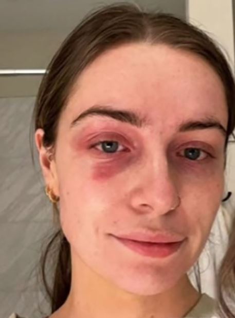 Erin 1.jpg