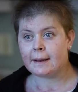 Ema žrtva požara.png