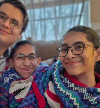 Sijamske bliznakinje