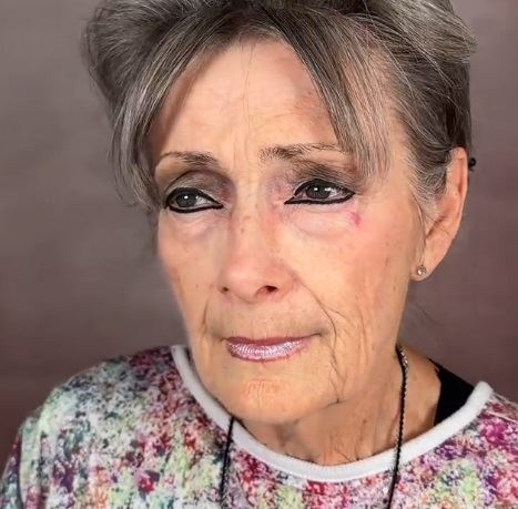 plastična hirurgija16.jpg