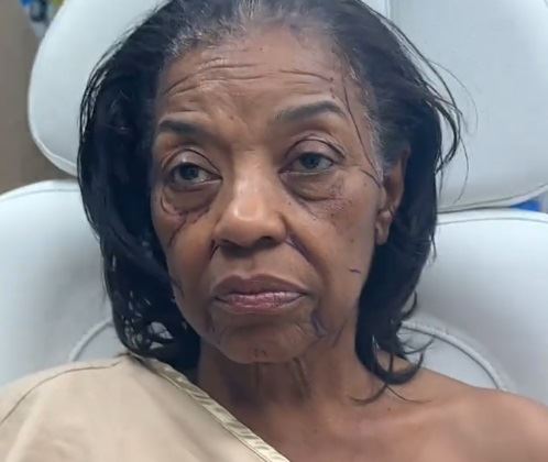 plastična hirurgija.jpg