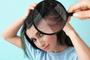 stockphotolookingatwomanshairthroughmagnifieronbluebackgroundproblemofdandruff2151683999.jpg